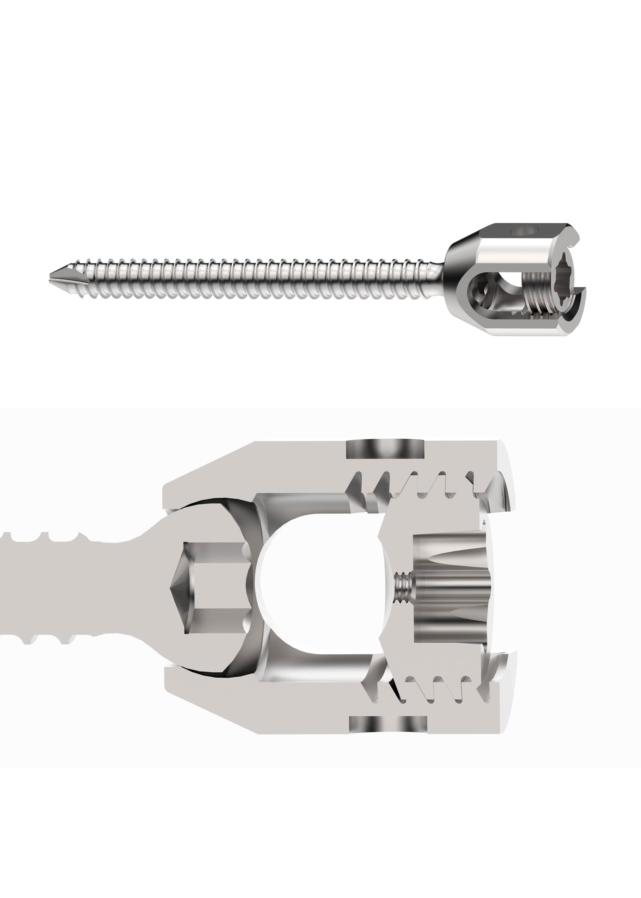 pedicle screw